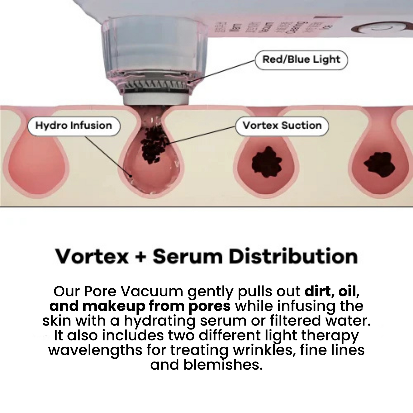Lumi™ HydraPore Acne Extraction Vacuum