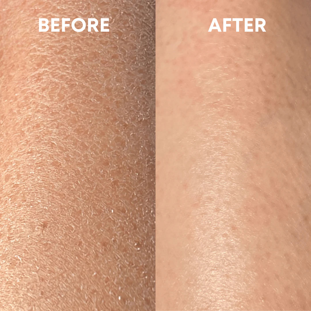 Lumi™ Deep Exfoliating Glove