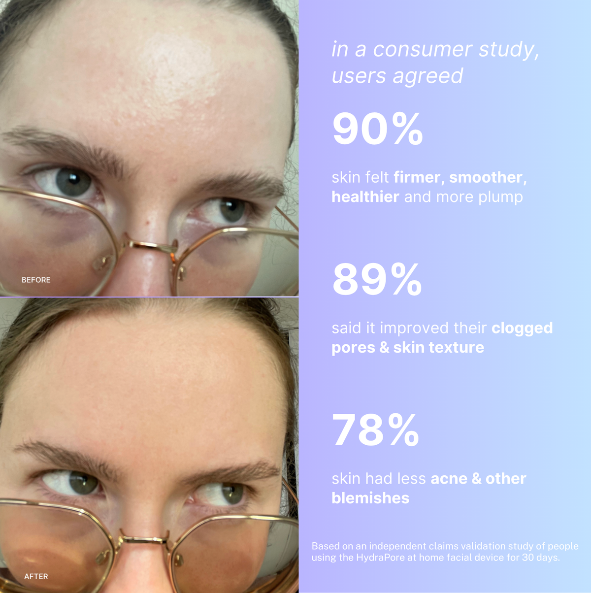 HydraPore™ - All in One Hydrafacial Pore Cleanser