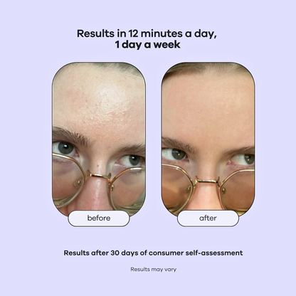 HydroPore™ - All in One Hydrofacial Pore Vacuum - LUMI