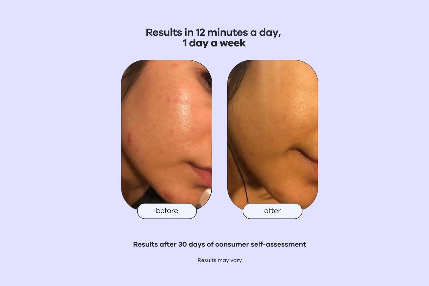 Copy of Untitled Design.png__PID:8f715566-a7da-4983-89a1-0aac1bc8edf5