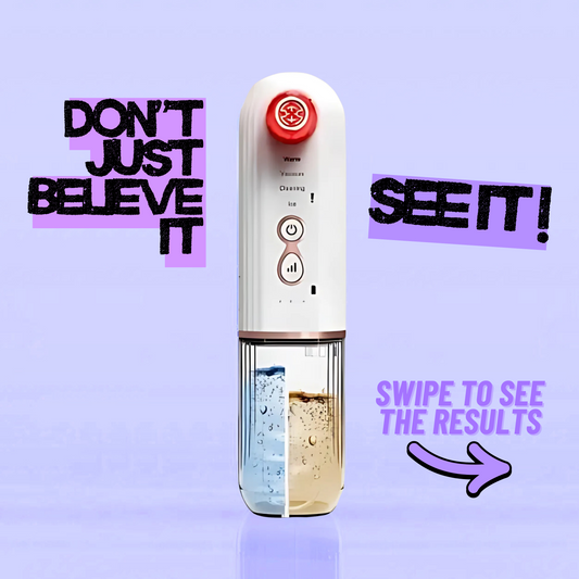 Lumi™ HydraPore Acne Extraction Vacuum