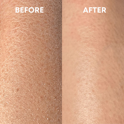 Lumi™ Deep Exfoliating Glove