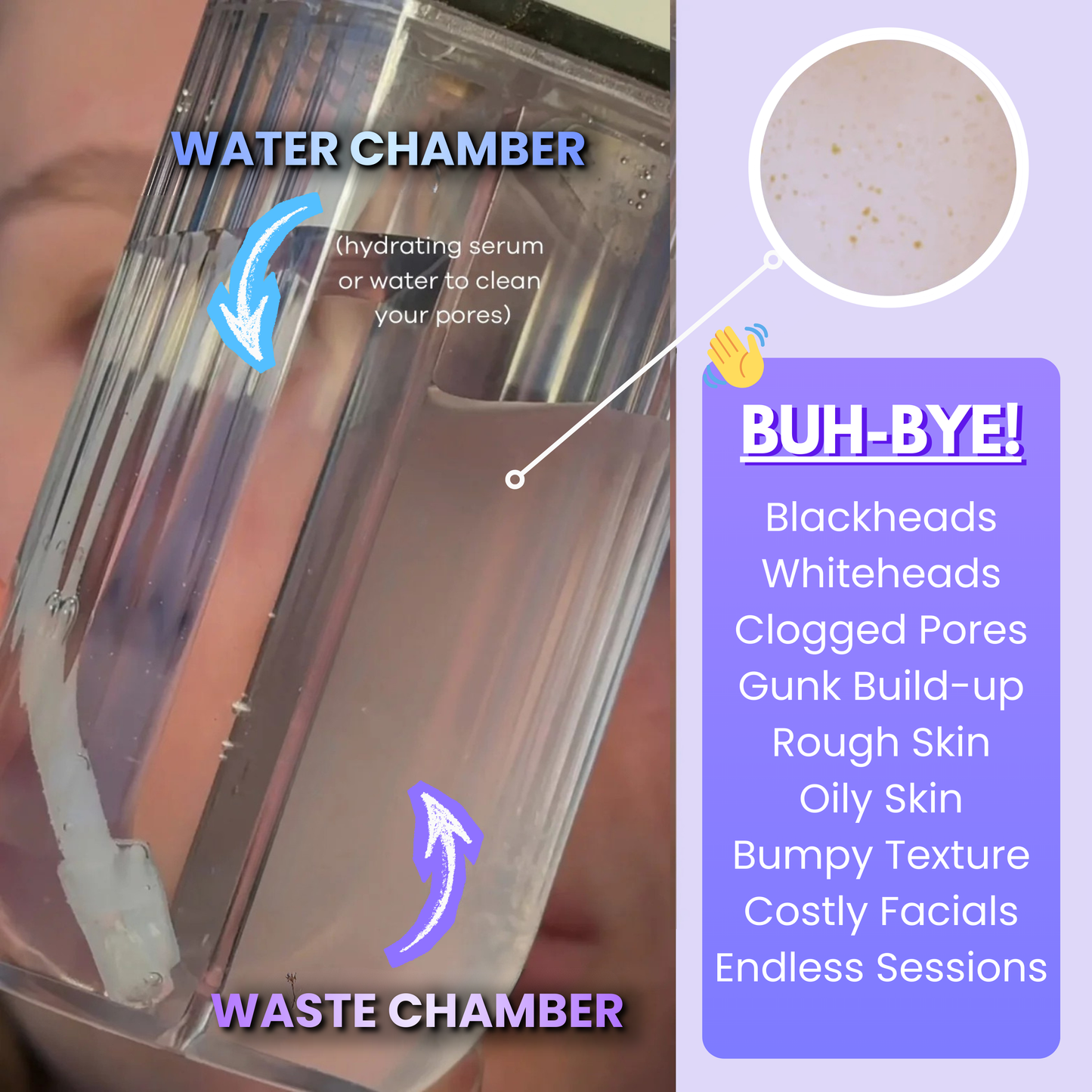 HydroPore™ - All in One Hydrofacial Pore Vacuum - LUMI